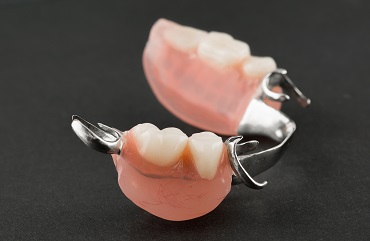 Partial Dentures