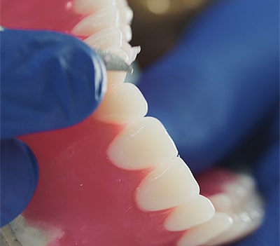 When Can A Denture Be Repaired