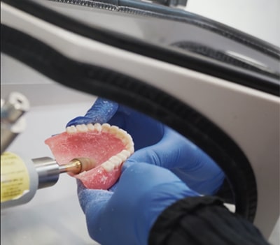 Replacing A Worn Denture